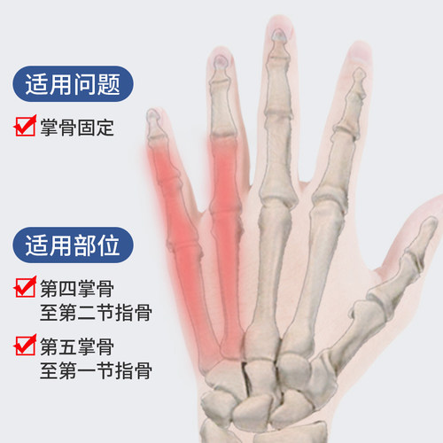 掌骨骨折固定器手掌手指固定护具夹板第五第四指套手腕小拇指支具 - 图2