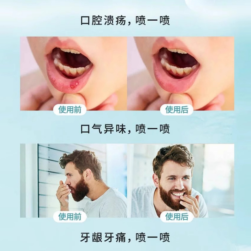 步长正品药店同款口腔清新喷雾-zmr