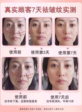 【小红书推荐】韩国抗皱小粉棒紧致淡化细纹提亮脸部颈部女生可用
