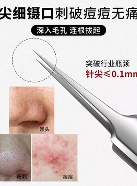 细胞夹镊子美容院专用挑挤痘痘黑头针去黑头神器细胞夹镊子夹拔尖
