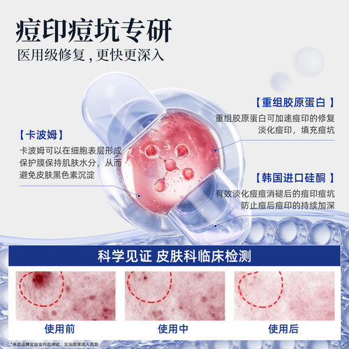 slot凝胶【院线同款】淡痘印slot硅酮凝胶evv凝胶rov硅酮凝胶mar - 图2