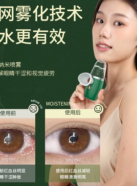 2025新款润眼仪蒸汽喷雾护眼仪近视眼部按摩仪缓解疲劳可携式洗眼