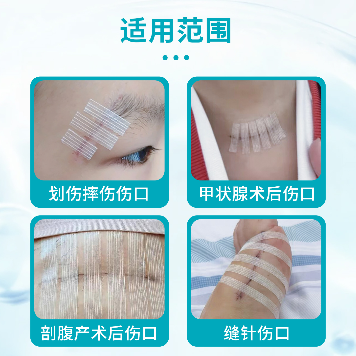 弘生医用减张贴皮肤伤口免缝胶带剖腹产甲状腺术后疤痕减张器透气 - 图3