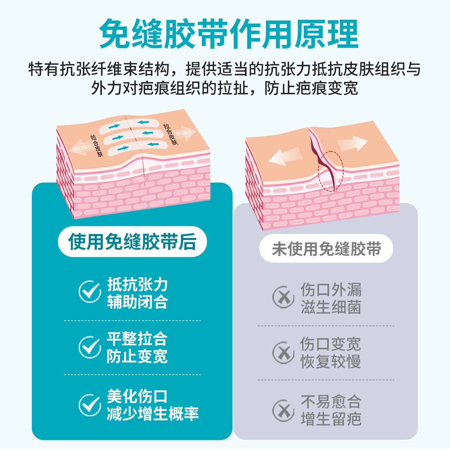 弘生医用减张贴皮肤伤口免缝胶带剖腹产甲状腺术后疤痕减张器透气 - 图2