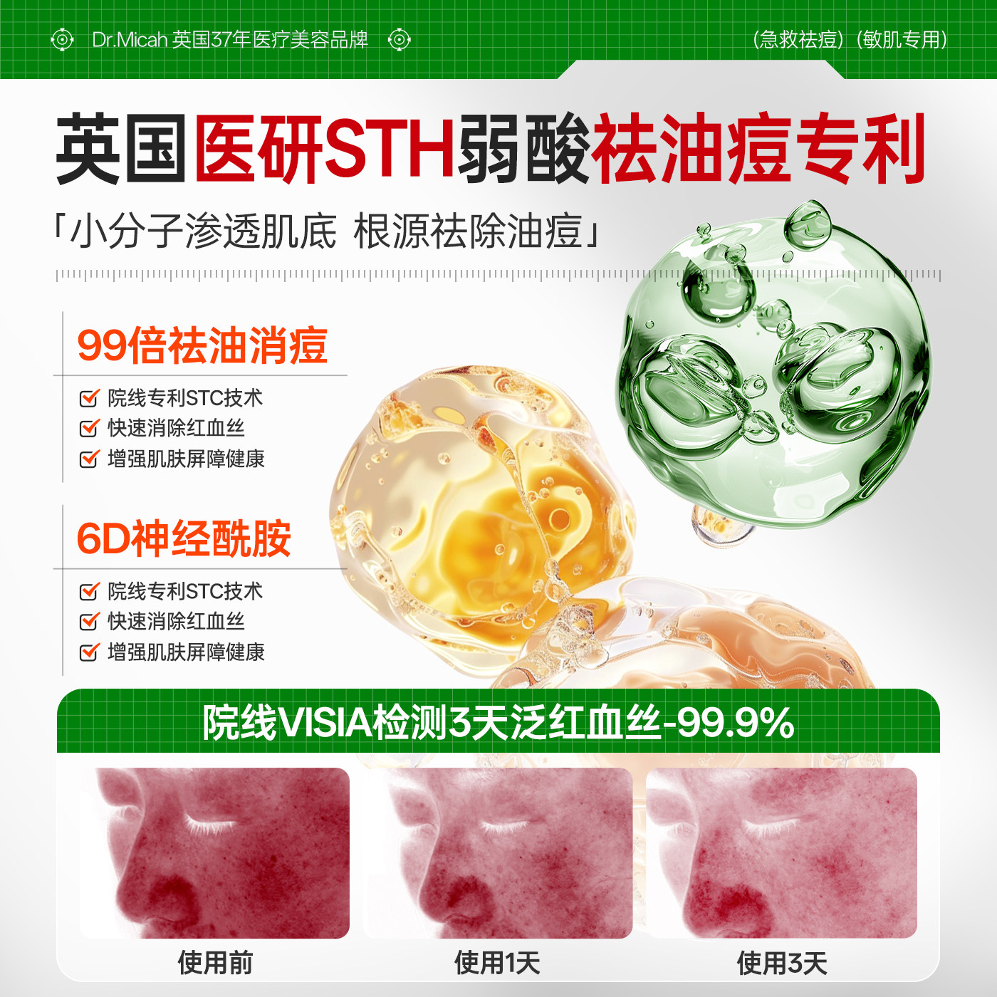 水杨酸棉片精华刷祛痘闭口粉刺黑头深层清洁湿敷收缩毛孔官方正品,淘宝优惠券,粉丝福利购,淘宝优惠卷