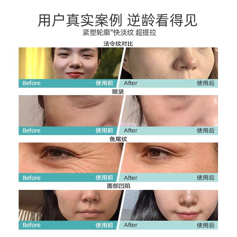 【院线专业级】EMS脉冲主机（不含其它配件),淘宝优惠券,粉丝福利购,淘宝优惠卷