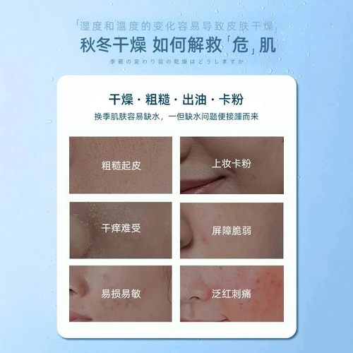 【徐艺洋同款】B5精华爽肤水保湿补水控油平闭口粉刺舒缓湿敷水正 - 图2