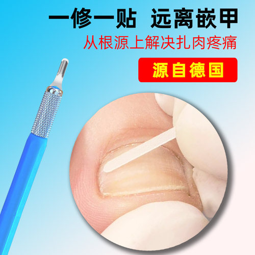 德国U型甲沟焱炎修甲刀指甲修脚工具家用指甲扎肉嵌甲修脚刀神器 - 图2