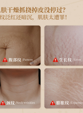 进口母婴专用胎脂身体乳保湿