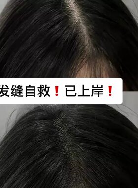 发际线粉填充神器补发防水防汗发髻线修容阴影笔自然遮高额头正品