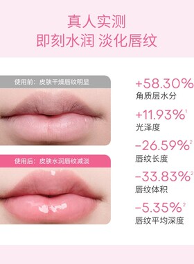 凸凸兔唇部水光精华滋润淡纹养唇