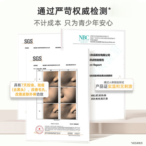 袋鼠妈妈青少年去黑头鼻贴导出液初高中青春期舒缓控油痘收缩毛孔 - 图2