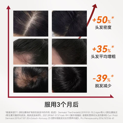 labvinas防脱固发胶囊进口生物维生素食补养育增密内调胱氨酸3盒 - 图0