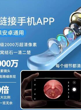 扁桃体结石去除工具摄像头口腔喉咙异物取出器扁桃体结石清洁工具