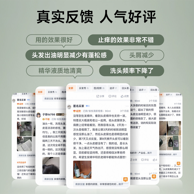 发现者HairWiz痒屑油头皮精华液控油蓬松去头屑止痒舒缓护理精华,淘宝优惠券,粉丝福利购,淘宝优惠卷