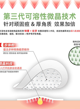 刺猬仔微晶祛痘贴快速祛痘不留印