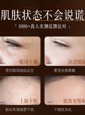 【预防初老】黄芪抗皱淡纹保湿霜