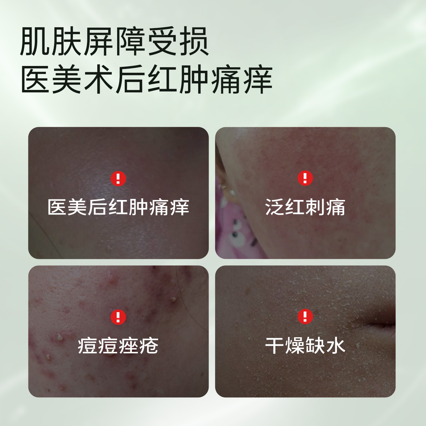 科复佳透明质酸医用敷料敷贴医美术后屏障受损敏感保湿修护非面膜