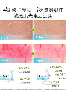 Infodplus弱酸修护高保湿面霜