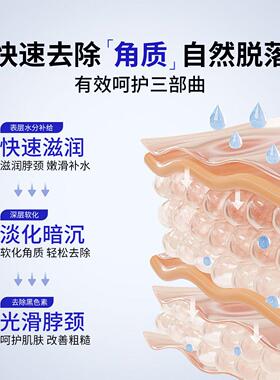 儿童脖子黑色素沉淀去除小孩黑棘皮颈部深层清洁淡化美白霜CX