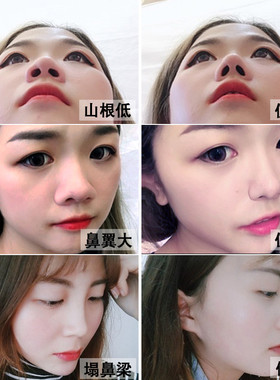 【小红书推荐 美鼻神器】告别丑鼻子精油变高山根鼻梁精华液