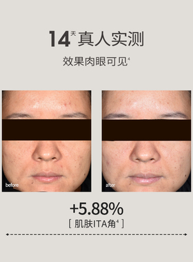 SOUNDER ONE 三蛋丸30%VCIP光感清透精华油抗皱紧致Sounder One