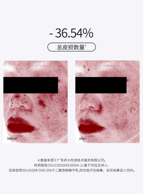 Sounder One15%壬二酸净颜精华乳祛痘控油舒缓SOUNDER ONE