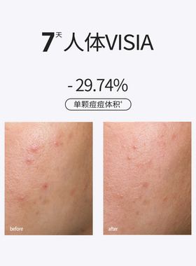 Sounder One【米奇科宁专属2C】20%壬二酸密集焕颜乳霜