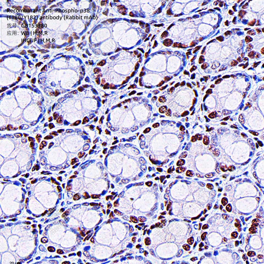 现货 Recombinant Anti-Phospho-p38 (T180/Y182) antibody (Rabbit mAb) GB153380 100ul 科研生物实验抗体 - 图0