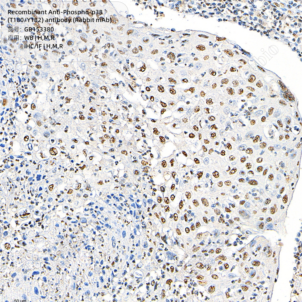 现货 Recombinant Anti-Phospho-p38 (T180/Y182) antibody (Rabbit mAb) GB153380 100ul 科研生物实验抗体 - 图1