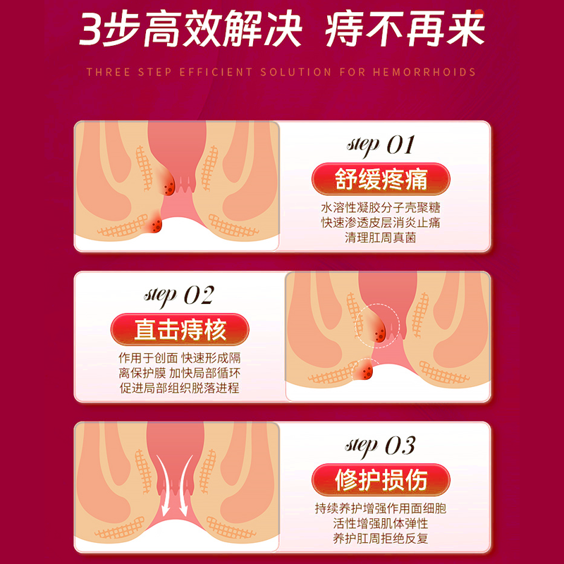 九芝堂医用卡波姆痔疮敷料内外痔混合痔肛门坠痛粘膜充血凝胶软膏,淘宝优惠券,粉丝福利购,淘宝优惠卷