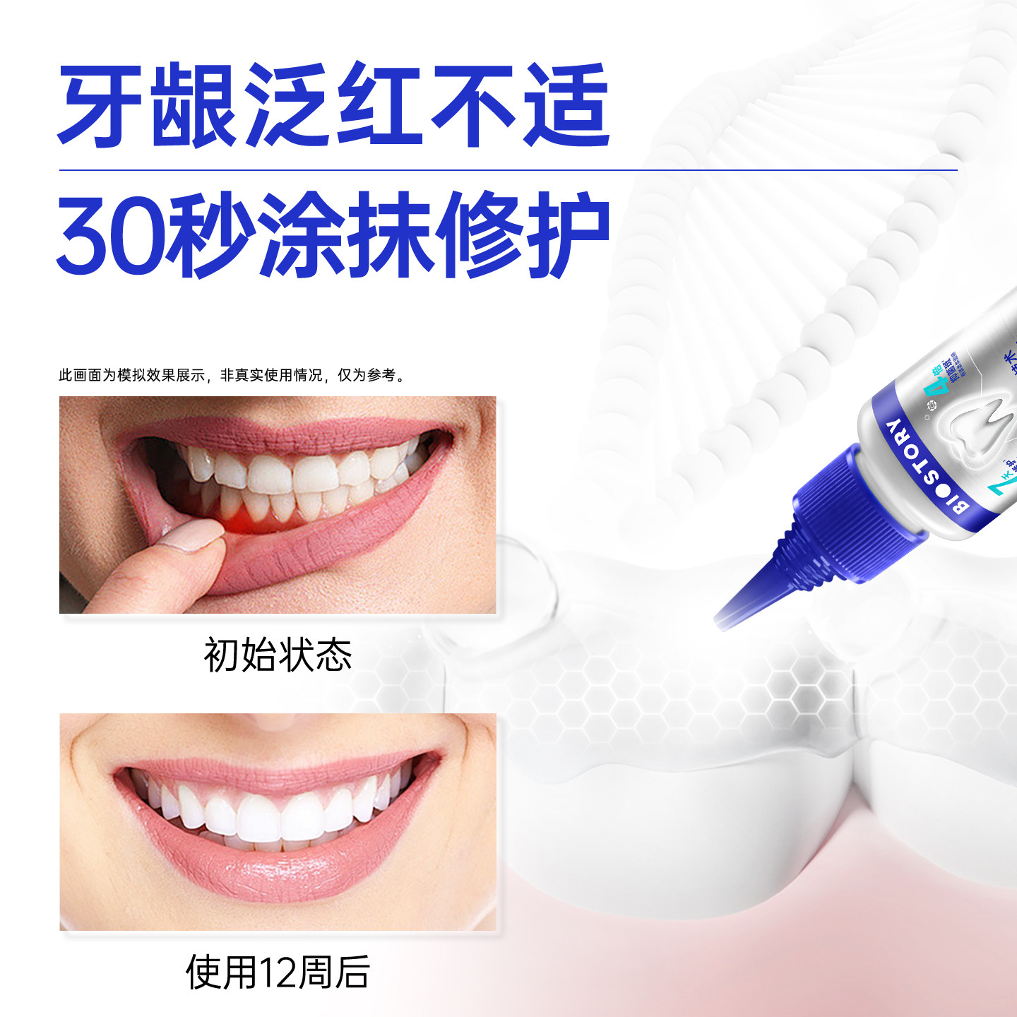 倍爱健牙龈精华牙膏牙结石牙菌斑牙龈出血牙周炎蜂寡肽口腔护理,淘宝优惠券,粉丝福利购,淘宝优惠卷