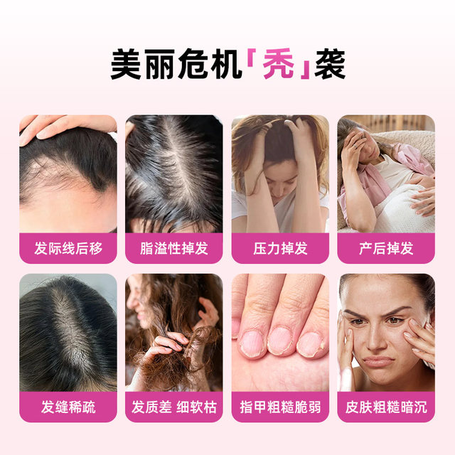 Vegitalk Biotin Iron Hair Nutrition Capsules