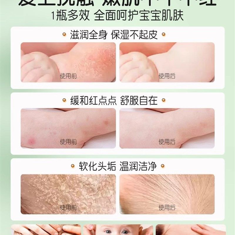 葵花抚触油新生婴儿专用山茶油护肤儿童按摩油孕妇宝宝身体润肤油,淘宝优惠券,粉丝福利购,淘宝优惠卷