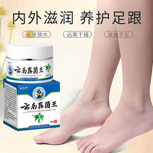 云南真菌王脚后跟手足脱皮开裂膏粗糙干裂抑菌膏官方旗舰店正品 - 图1