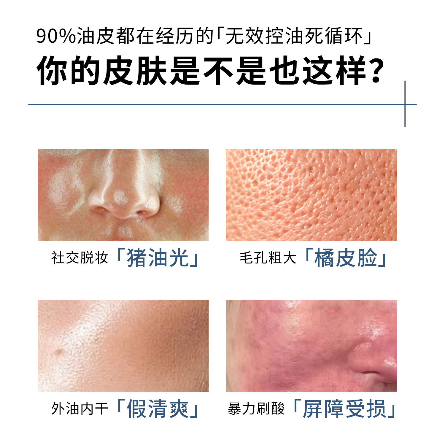sqt油皮精华次抛 控油紧致收缩毛孔 油皮肌专研毛孔调理精华2ml*2