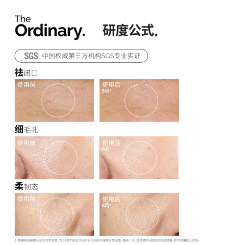The Ordinary研度公式5%果酸水甘醇酸爽肤水去角质闭口提亮油皮 - 图0