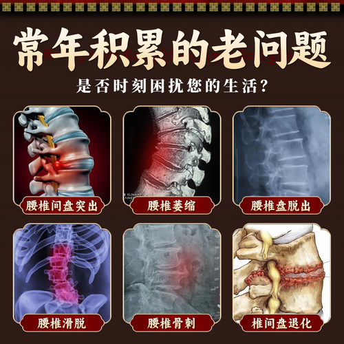 藏秘远红外治疗贴腰椎型腰椎间盘突出腰肌劳损疼痛缓解腰椎问题 - 图0