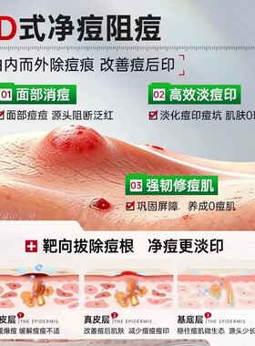 15%壬二酸凝胶祛痘膏祛痘印黑头