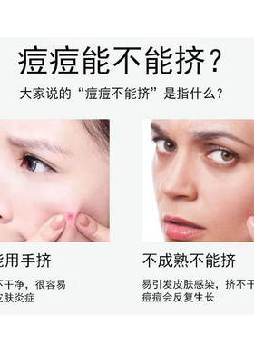 海菲诺细胞夹粉刺针套装