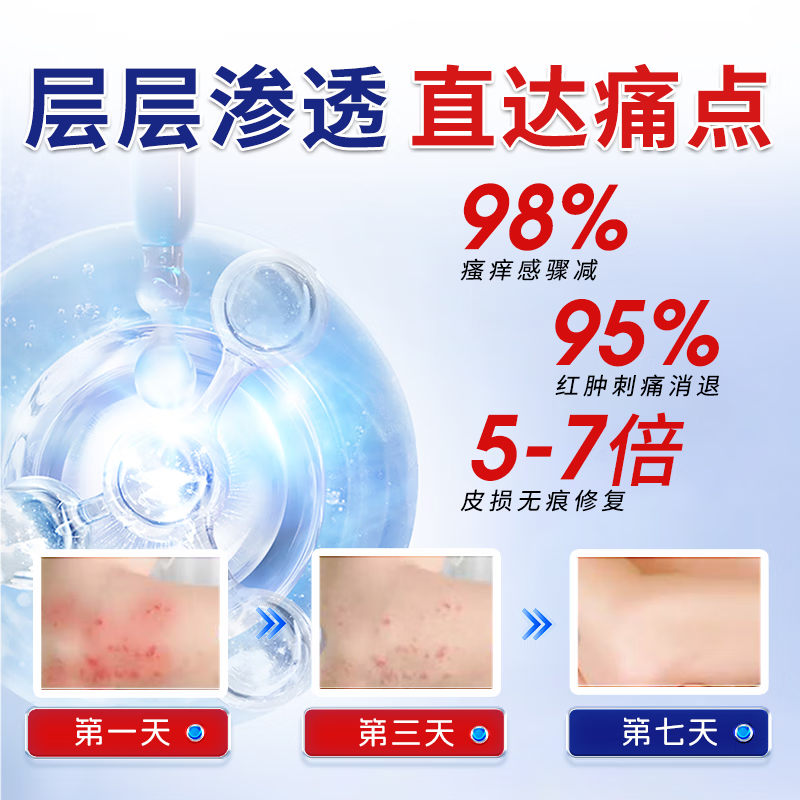 守诚堂医用皮肤护理软膏湿疹膏顽固皮炎湿疹止痒膏水泡湿疹瘙痒,淘宝优惠券,粉丝福利购,淘宝优惠卷