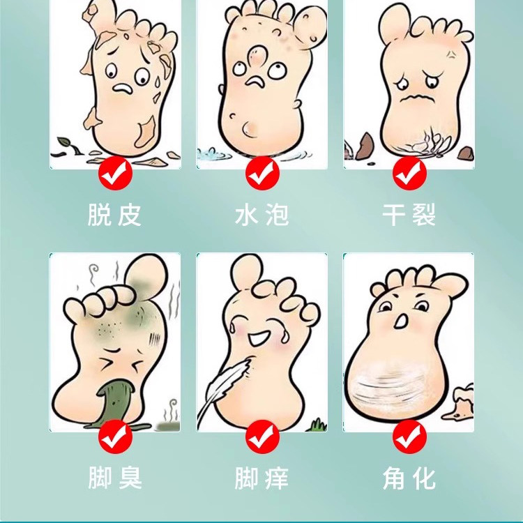【云南本草】杀菌脚气喷雾60ml*3瓶