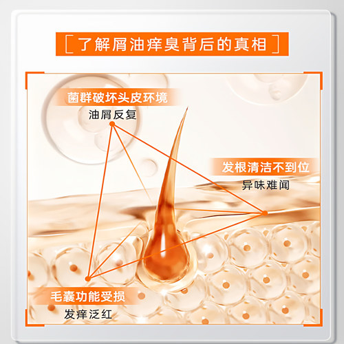 【天猫U先】尚康源洗发水去屑止痒油官方旗舰店清爽体验装10ml*4 - 图2