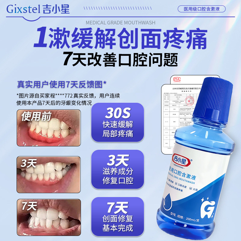 漱口水杀菌口臭牙结石口气持久留香清新洁口腔消炎抗菌护理,淘宝优惠券,粉丝福利购,淘宝优惠卷