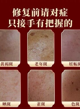 【先沟通后下单】祛斑霜祛黄褐斑雀斑老年斑晒斑淡化色斑祛黄溶斑