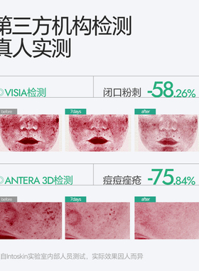 Intoskin韩国进口PDRN祛痘琥珀酸精华液去痘印痘坑快速修复瘪痘
