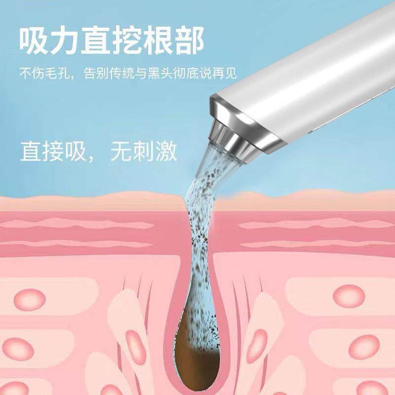 漫盈家用智能黑头导出仪电动可视吸黑头粉刺可视化高清吸黑头利器,淘宝优惠券,粉丝福利购,淘宝优惠卷