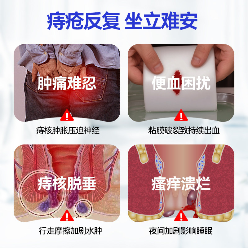 医用痔疮凝胶内痔混合痔大便出血肛门瘙痒肿痛专用凝胶A