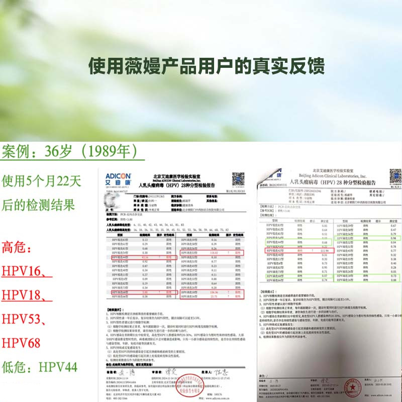薇嫚青蒿植物女性下面私处护理抑菌护理液3支装,淘宝优惠券,粉丝福利购,淘宝优惠卷