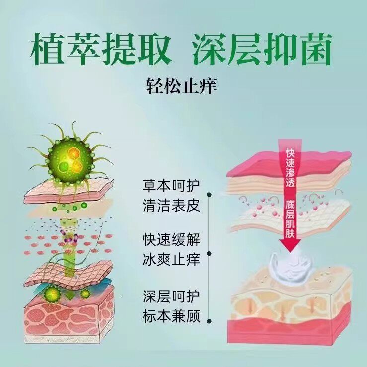 云南本草脚气除脱皮杀菌喷雾去烂脚丫止痒膏臭脚出汗脚痒水泡喷剂